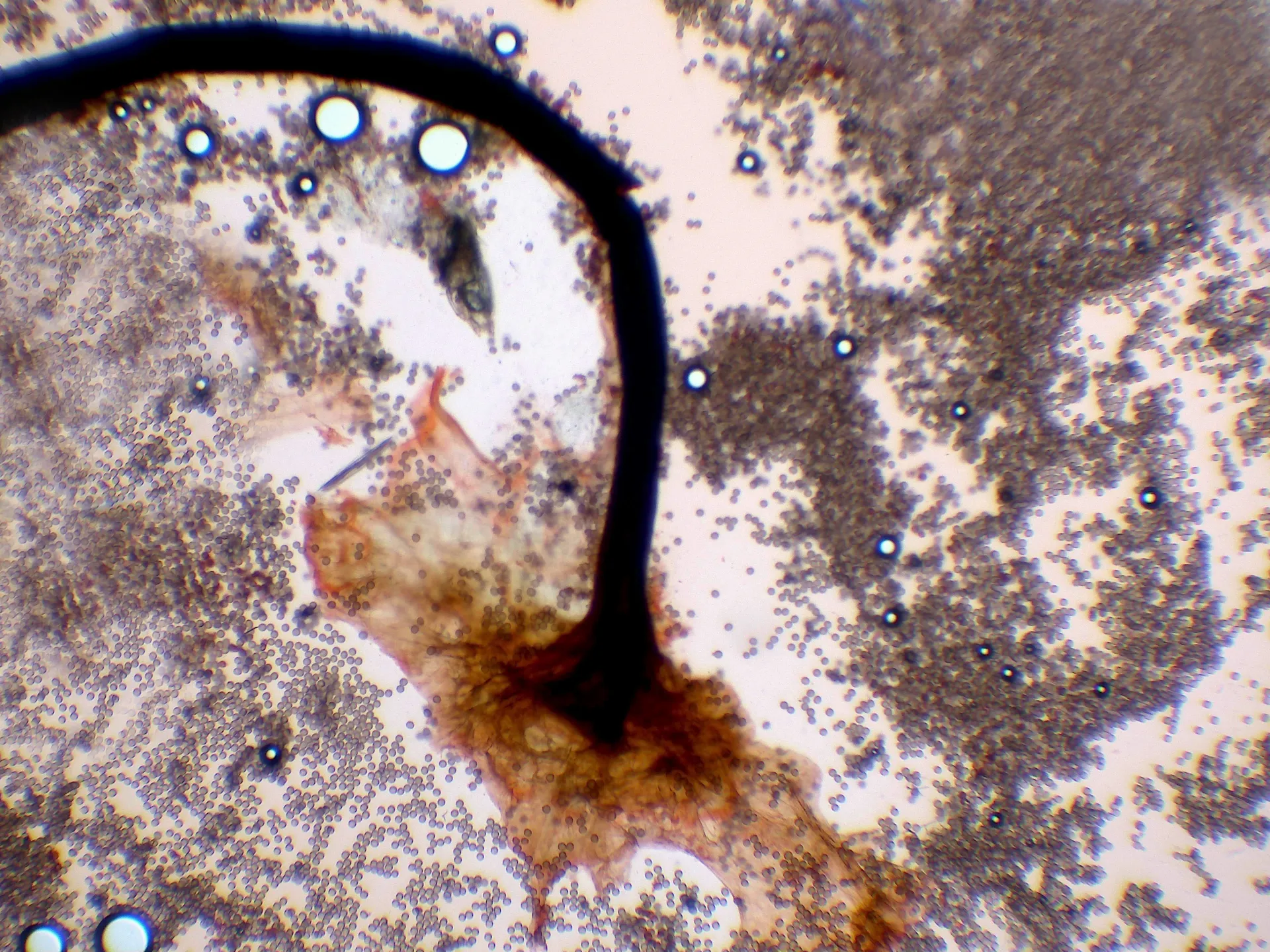 Microscopía de Stemonitis flavogenita - 10 - Pie x 100-001